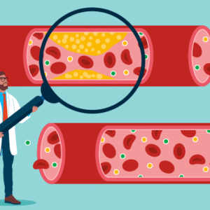 Blood Thinners & Anticoagulants